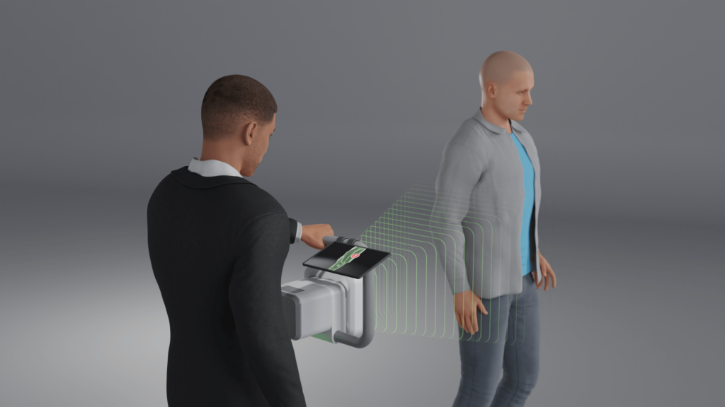 Millimeter-wave imaging system in people screening